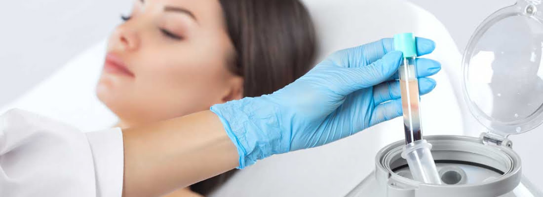 Doctor holding treatment tube on hand | Get to know about PRP in Beauty Boost Med Spa at Newport Beach, CA