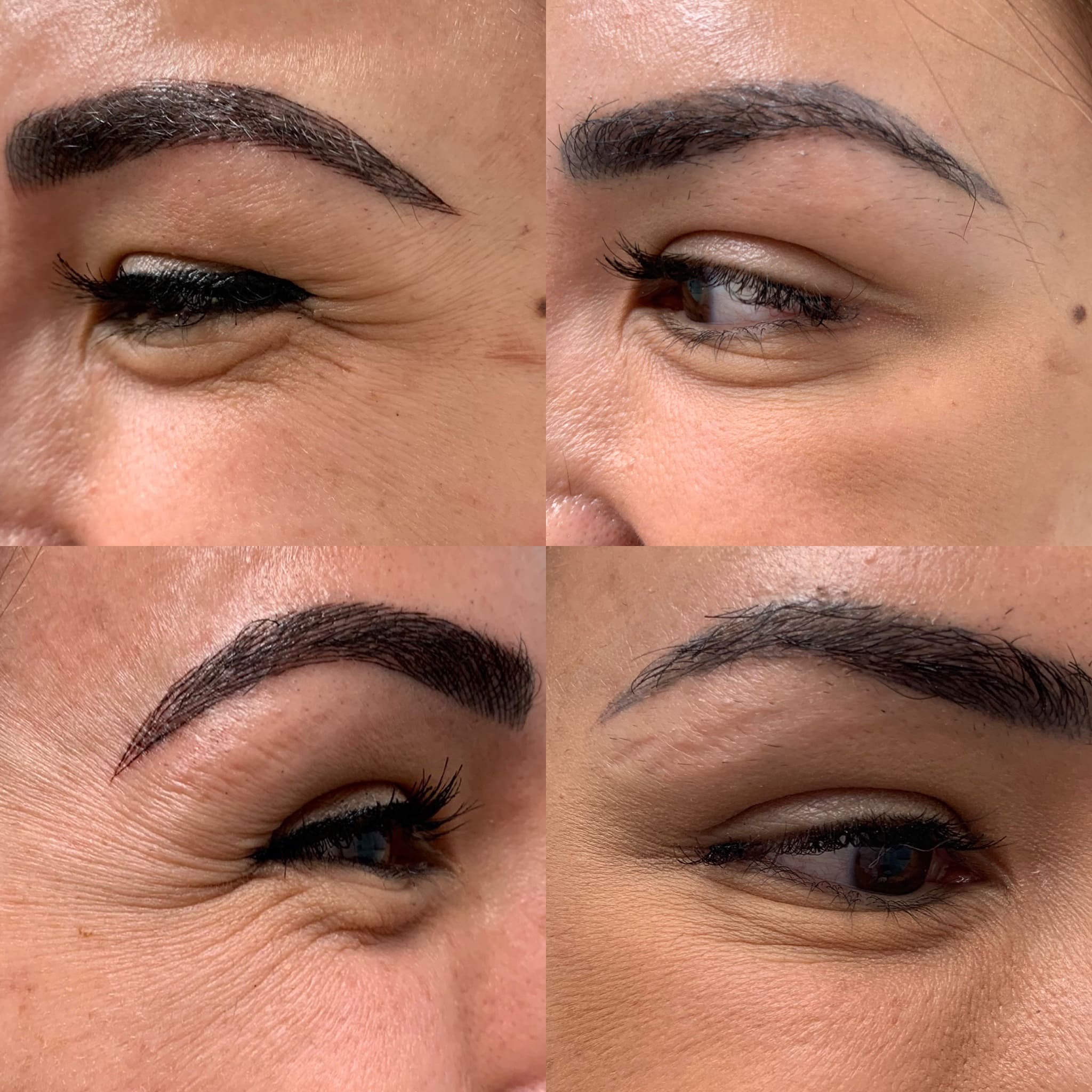Before and After treatment results on Eye Jelly roll | Beauty Boost Med Spa in Newport Beach, CA
