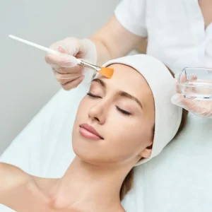 Chemical Peels in Newport Beach, CA | Beauty Boost Med Spa