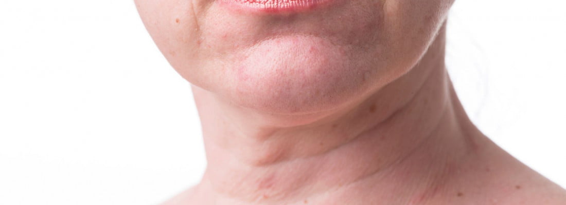 The neck of a Lady | Get rid from Pesky Lines in Neck in Beauty Boost Med Spa at Newport Beach, CA