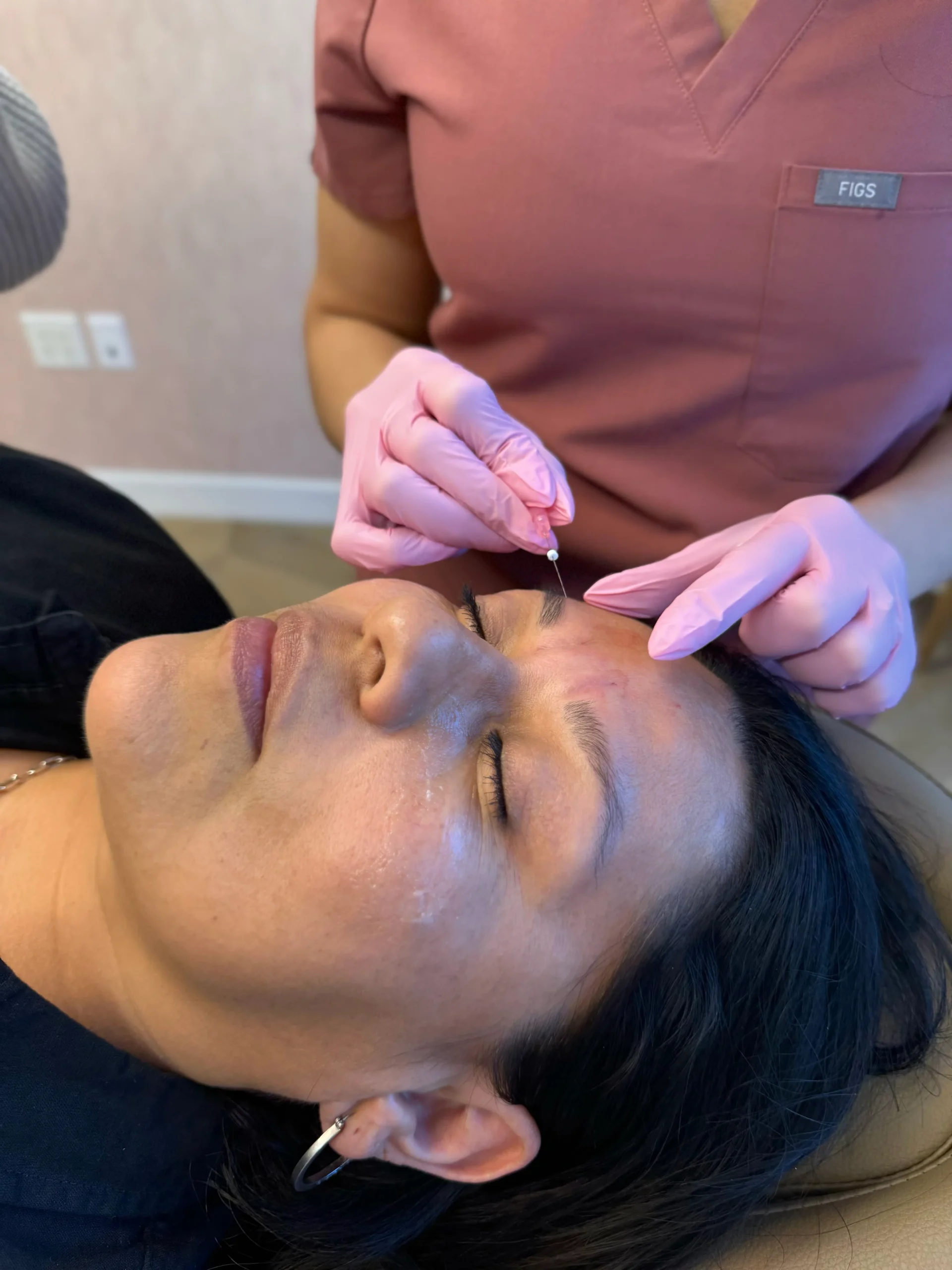 Smooth Threads in Newport Beach | Beauty Boost Med Spa