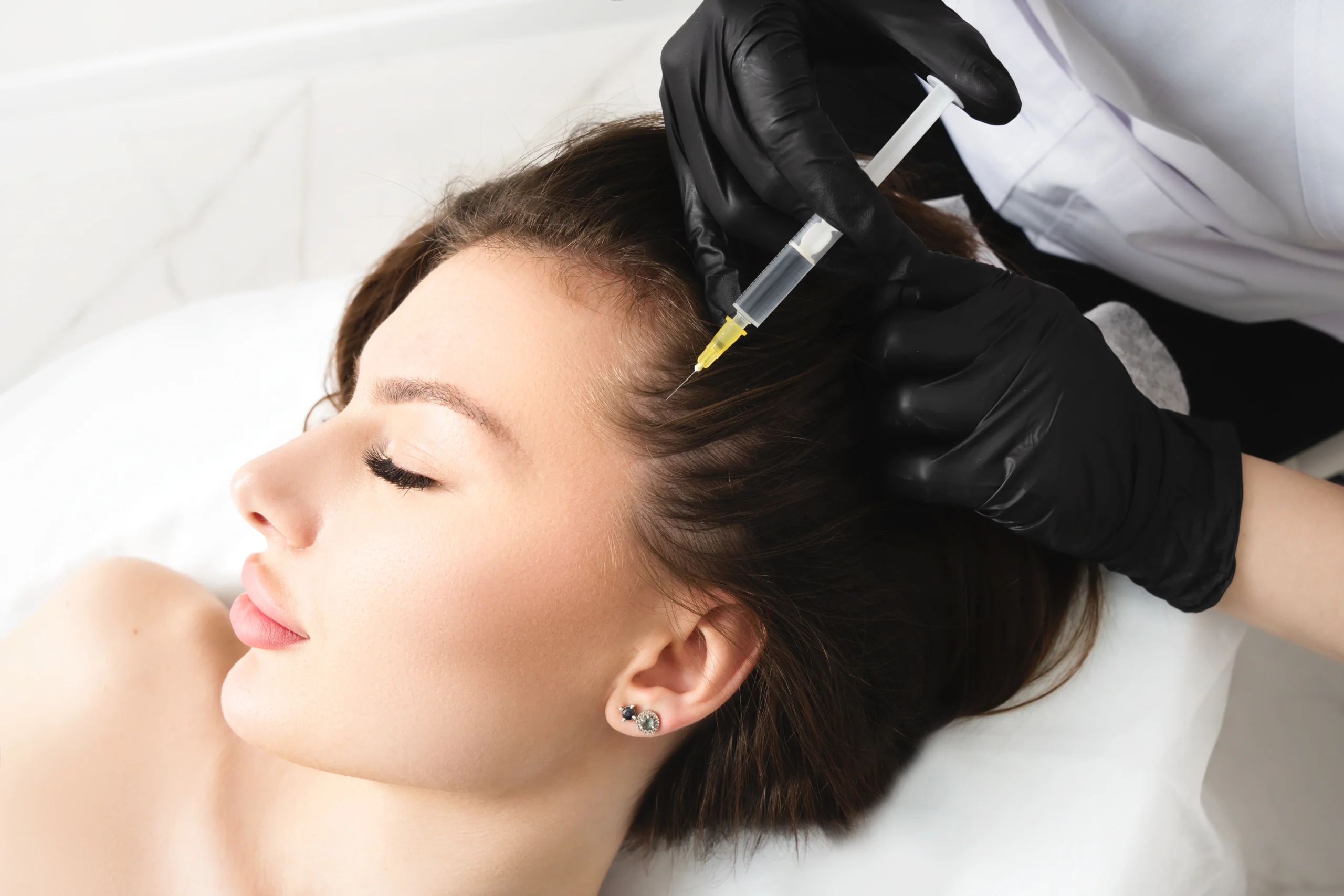 Thread Lift at Beauty Boost Med Spa in Newport Beach, CA