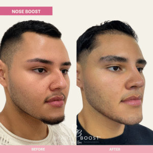 BBMS-NOSE-01-R oblique