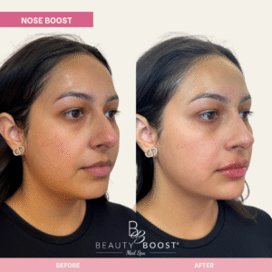 BBMS-NOSE-05-R oblique
