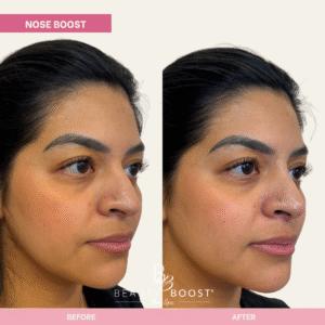 BBMS-NOSE-07-R oblique