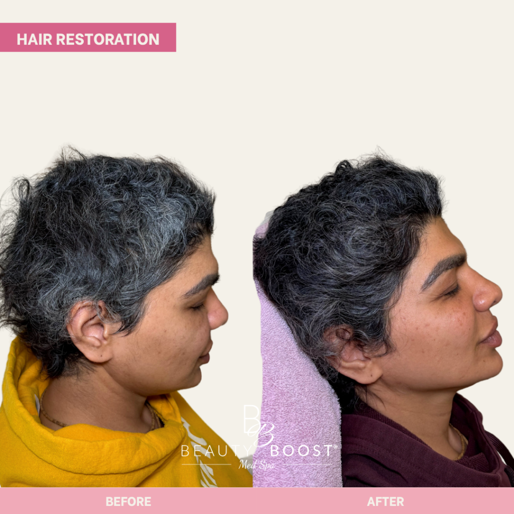 BBMS-hair-01-right