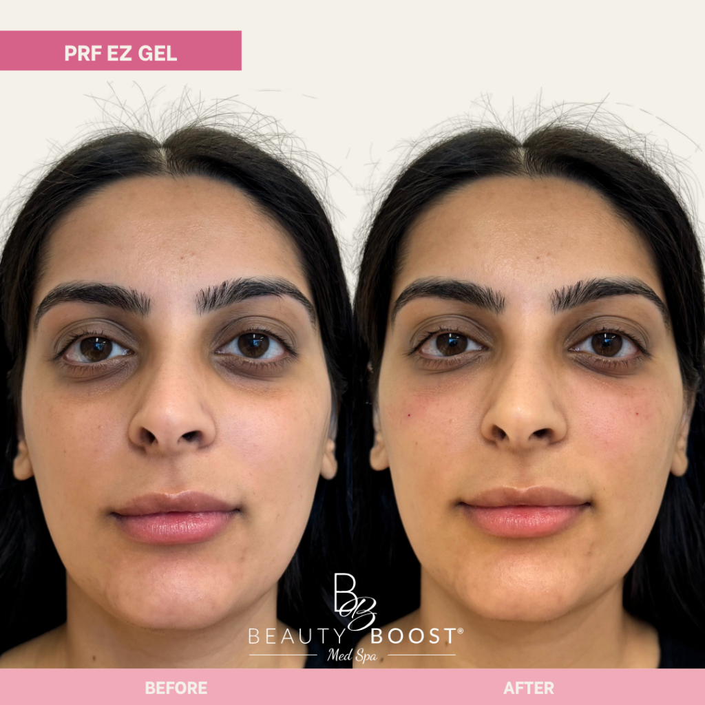 BBMS-PDGF-01-FULL FACE