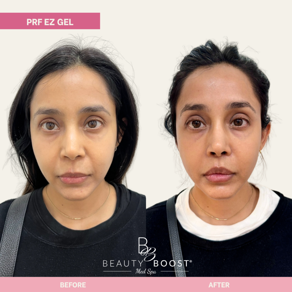 BBMS-PDGF-02-FULL FACE