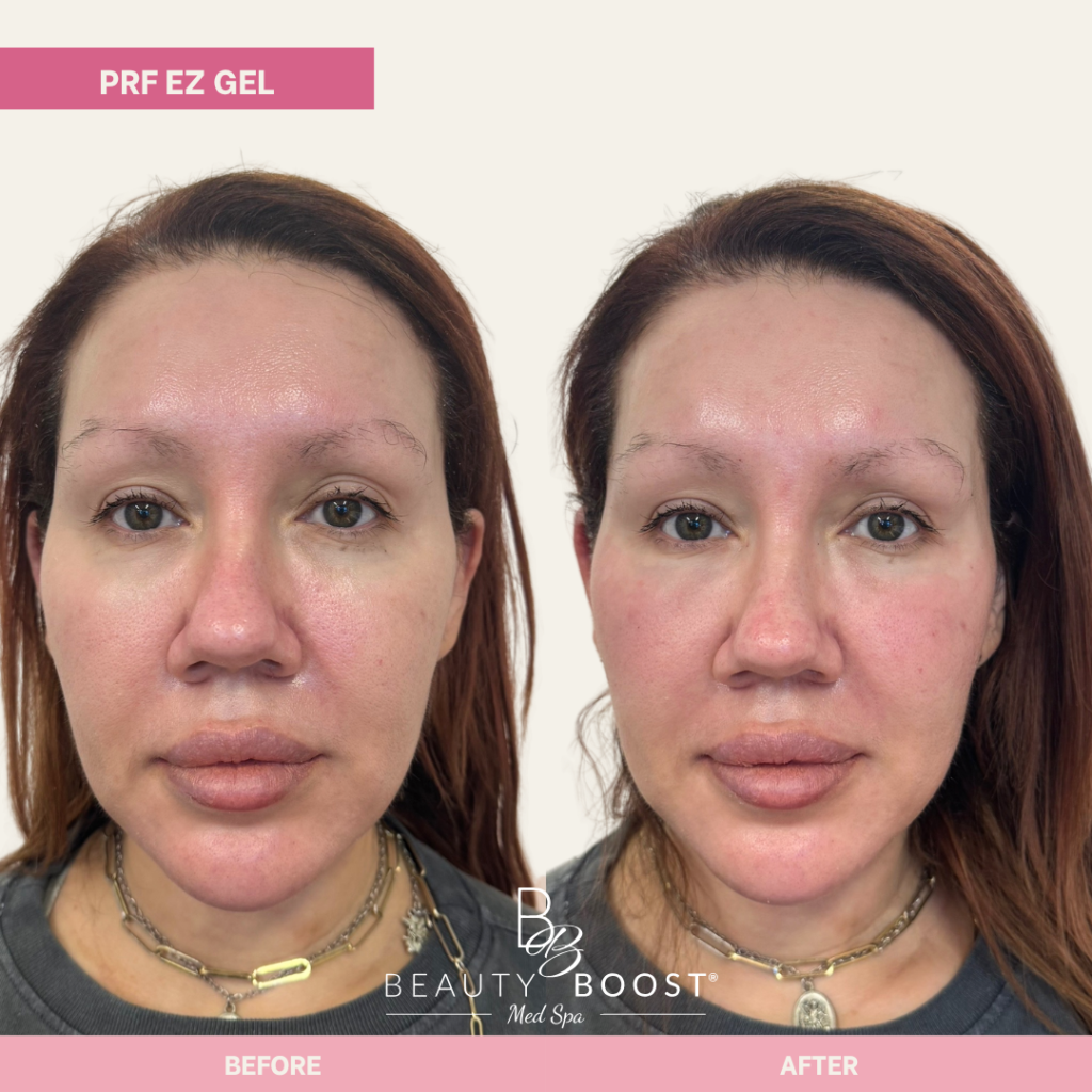 BBMS-PDGF-03-FULL FACE