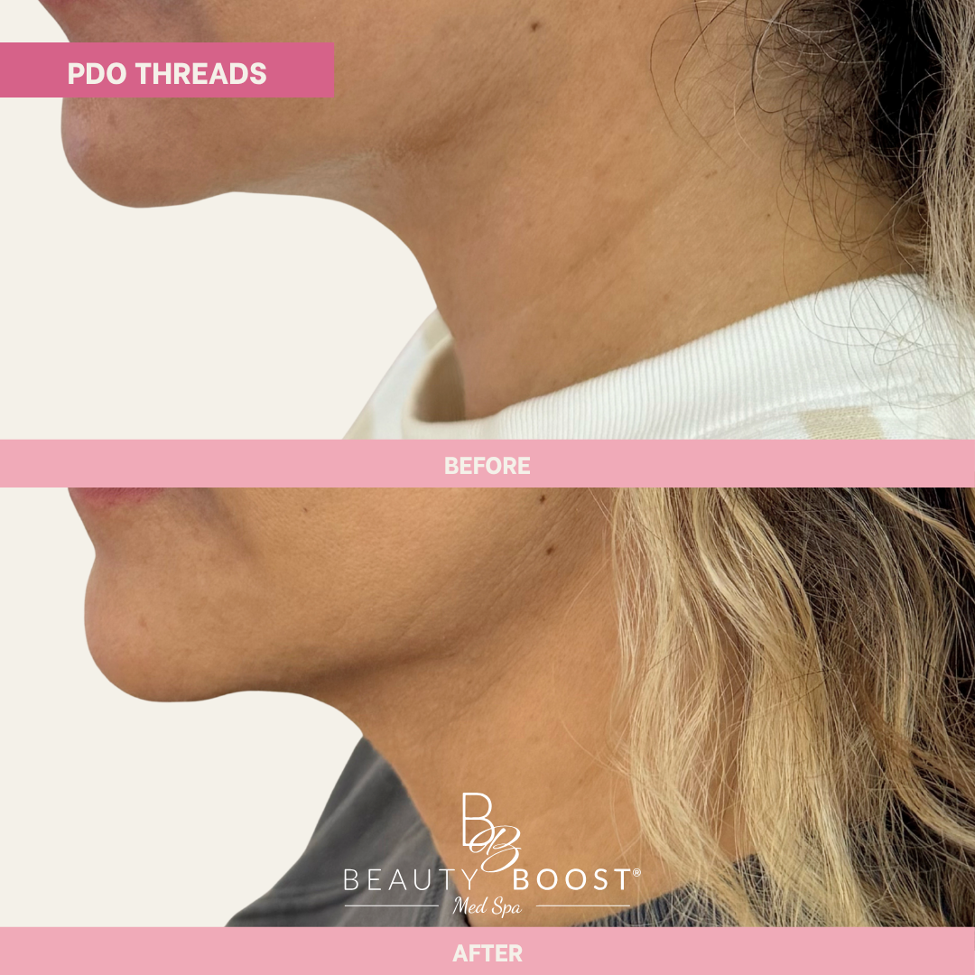 BBMS-PDOThreads-01