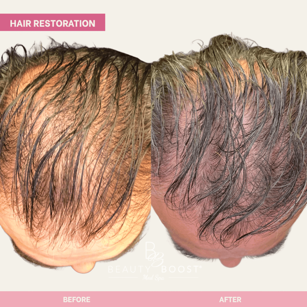 BBMS-hair-02-front (1)