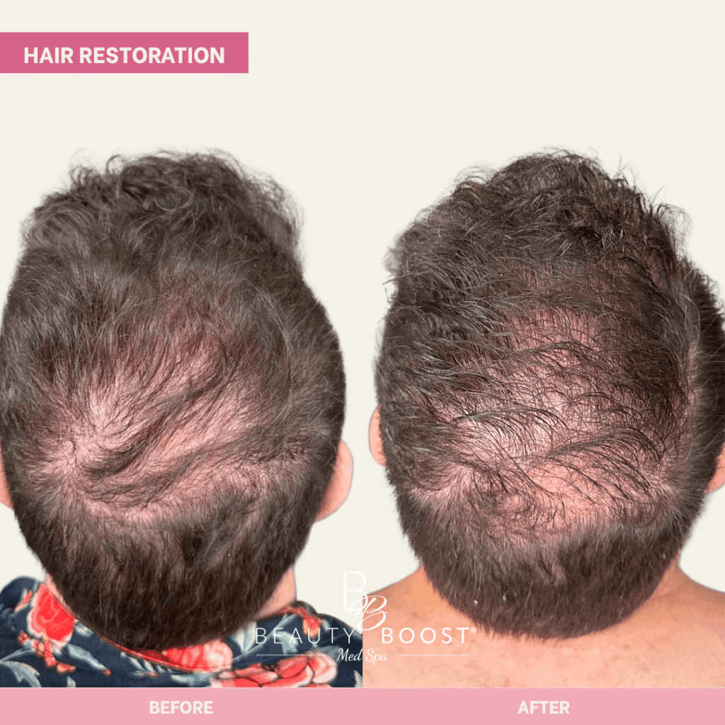 BBMS-hair-03-back (1)