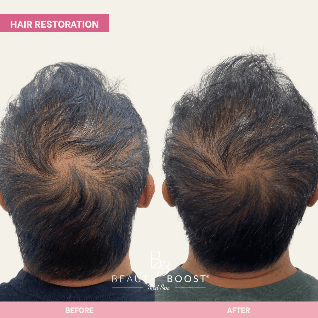 BBMS-hair-04-back (1)