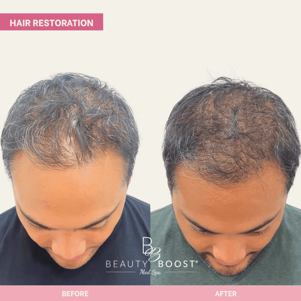 BBMS-hair-04-front (1)