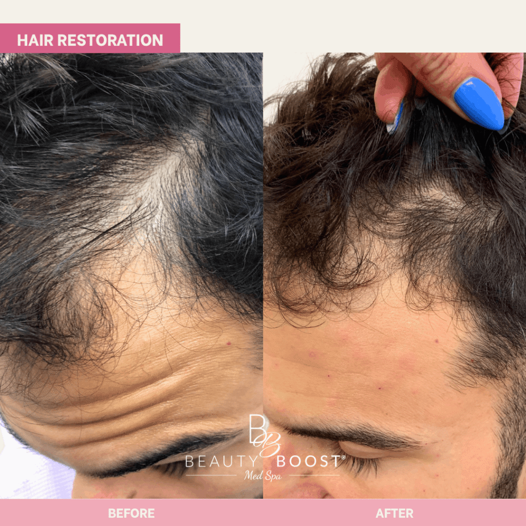 BBMS-hair-05-left (1)