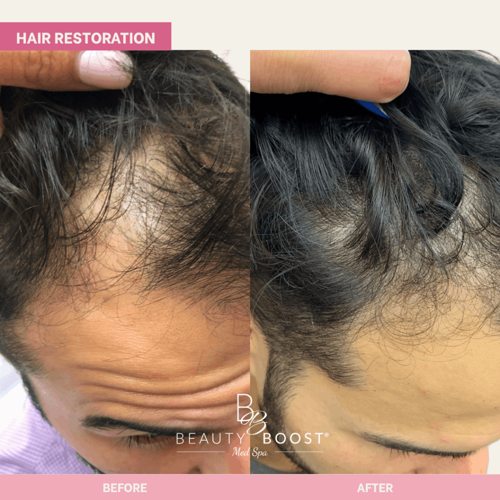 BBMS-hair-05-right (1)