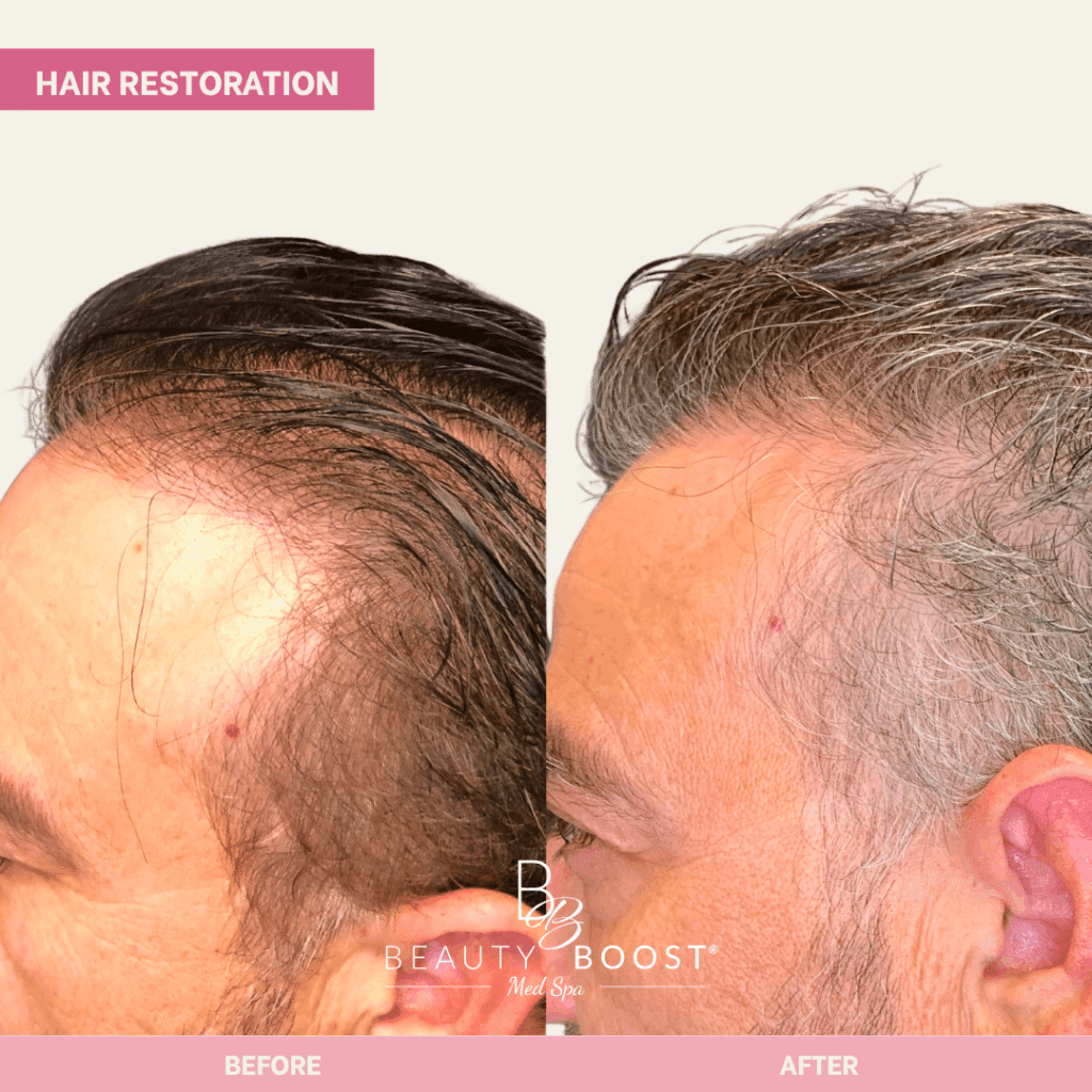 BBMS-hair-06-left (1)