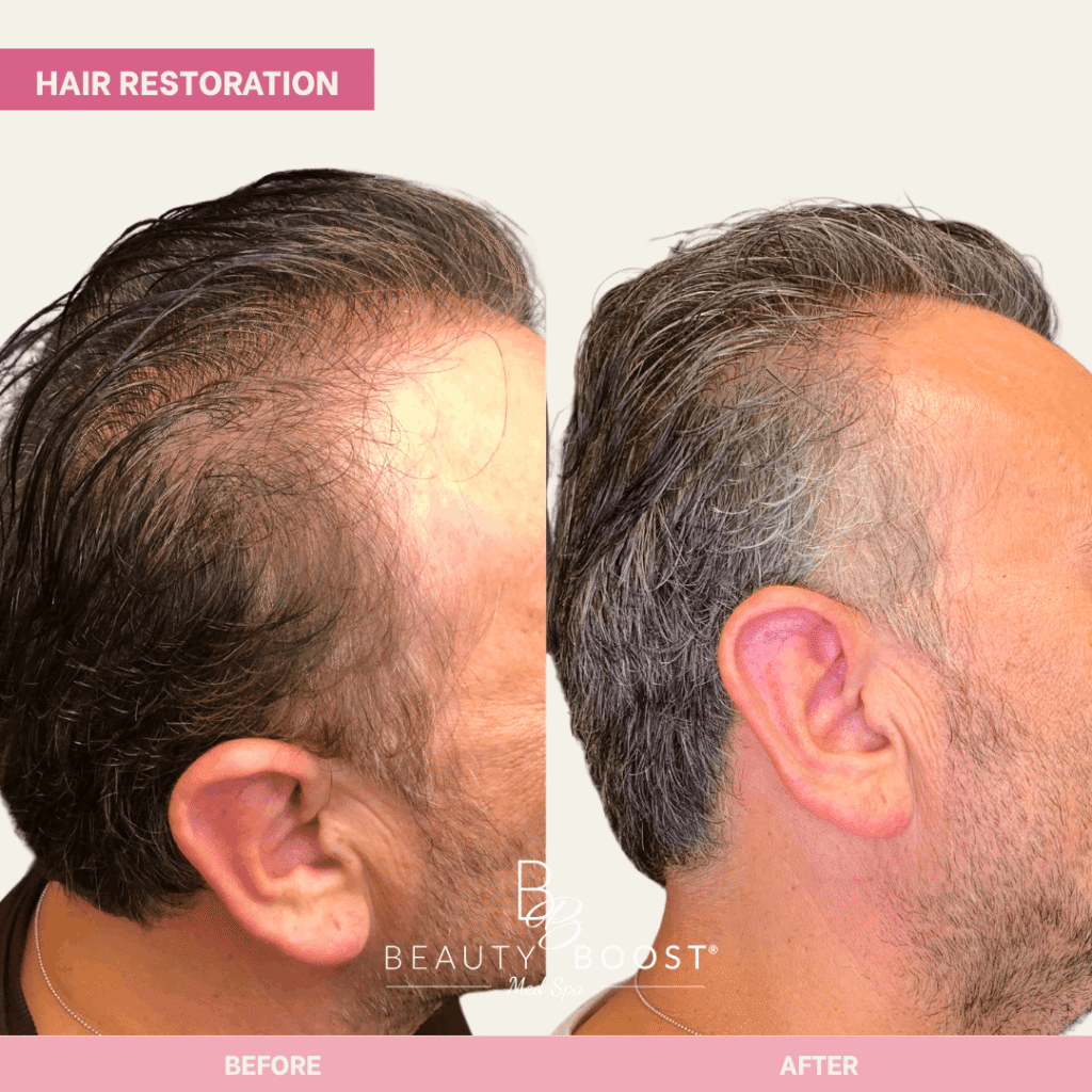 BBMS-hair-06-right (1)