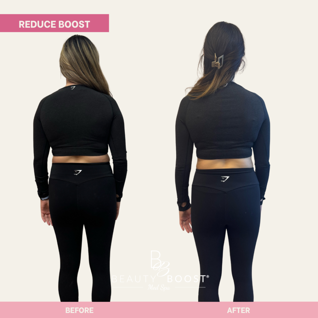 BBMS-reduce-boost-01-back
