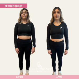 BBMS-reduce-boost-01-front