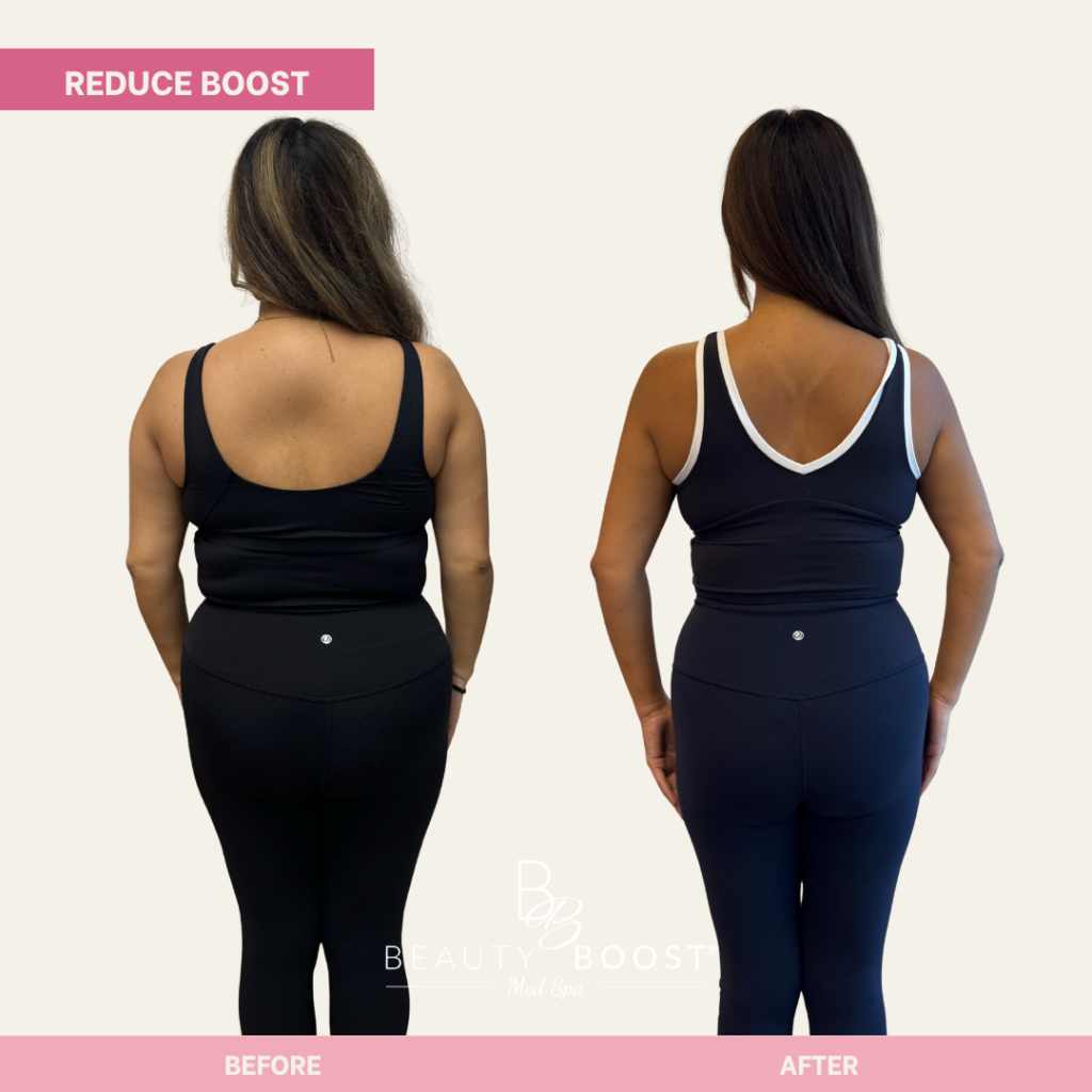 BBMS-reduce-boost-02-back