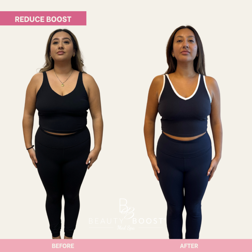 BBMS-reduce-boost-02-front