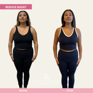 BBMS-reduce-boost-02-front