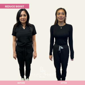 BBMS-reduce-boost-03-front