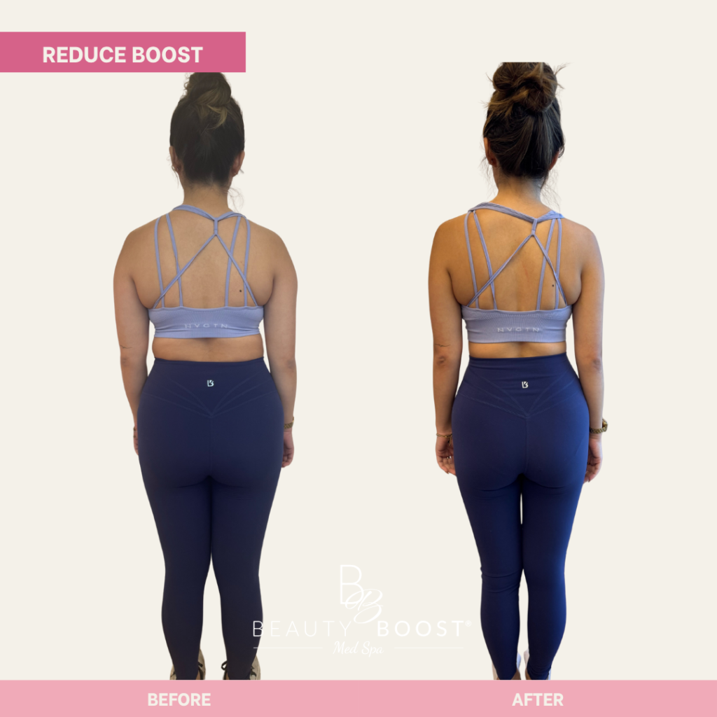 BBMS-reduce-boost-04-back