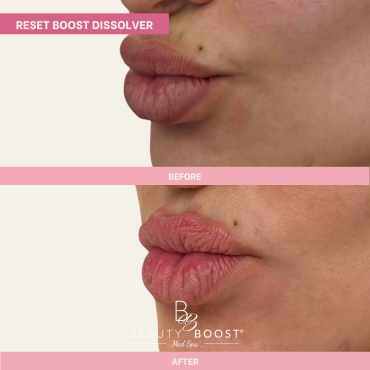 BBMS-DISSOLVER-01-LEFT