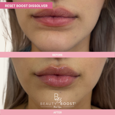 BBMS-DISSOLVER-03-FRONT