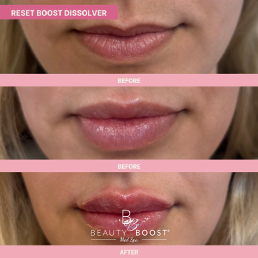 BBMS-DISSOLVER-04-FRONT